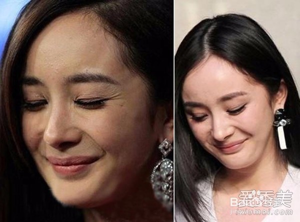 这8种肌肤问题概括了99%的人,你中了几枪?