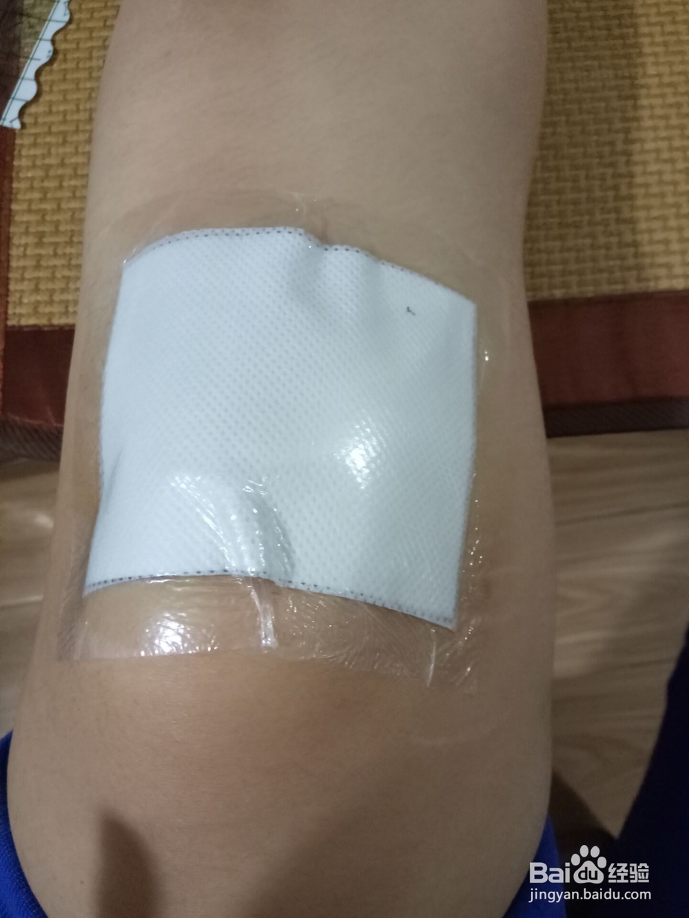 贴膏药注意的事项以及正确贴法