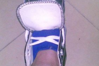 如何防止鞋舌头总是歪