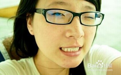 重庆妹子战胜痤疮的心得