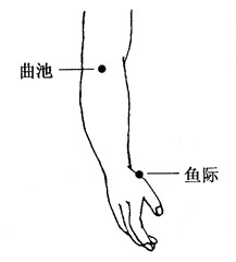 百病拔罐：[13]肺炎的拔罐疗法