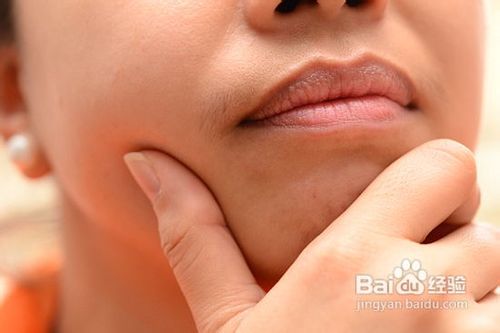 如何获得完美的牙齿