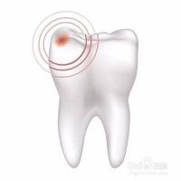 <b>牙疼的成因有哪些</b>