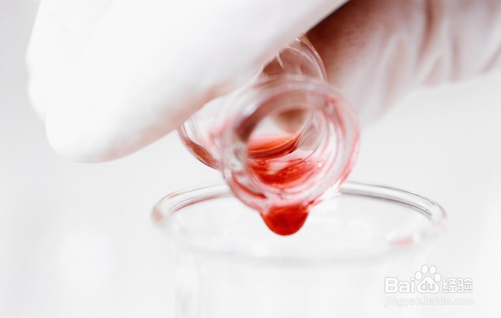 高血压患者哪些项目是必须检查