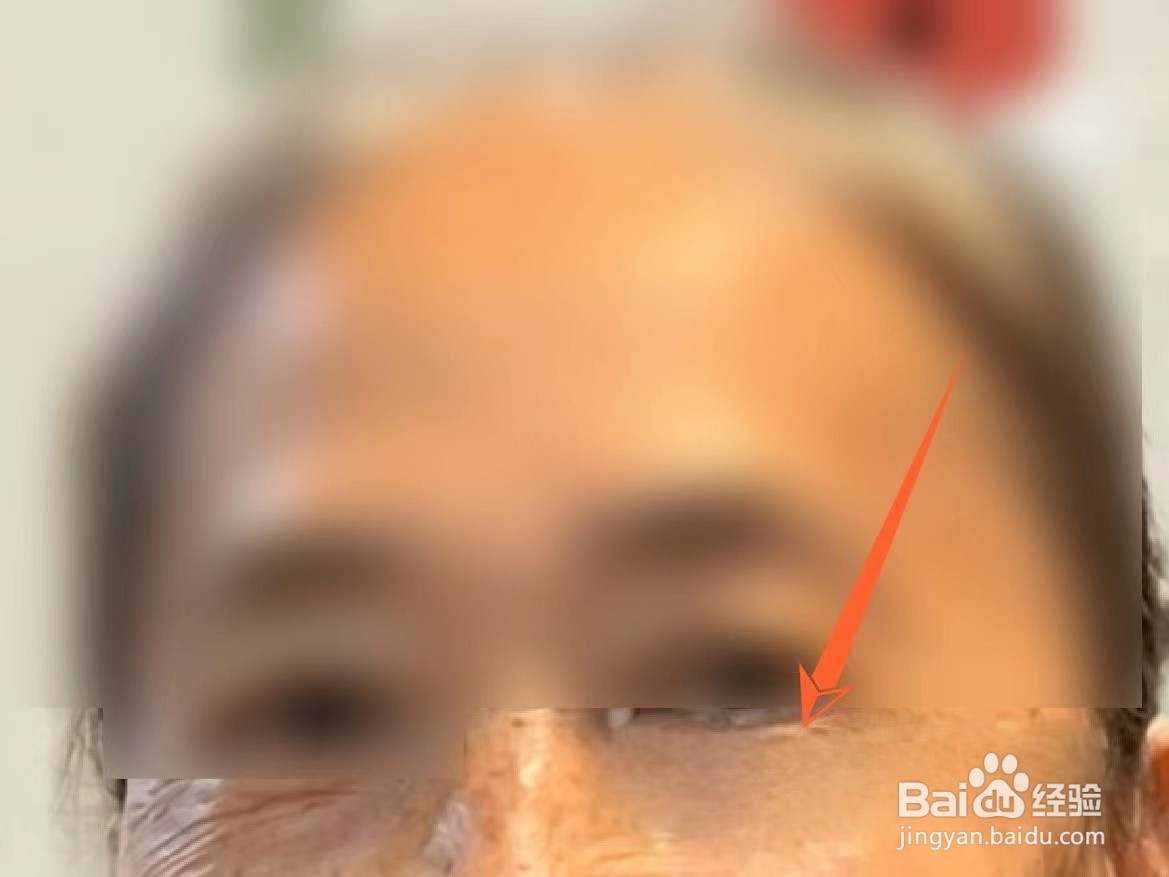 美图秀秀祛皱怎么用