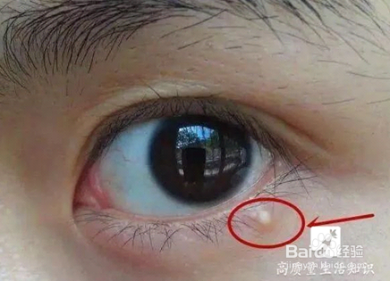 眼睛出现这些症状要当心!切莫忽视!Mkule是怎样提高眼睛抗衰能力的?