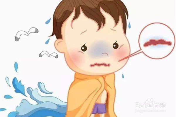 总是打喷嚏流鼻涕怎么办