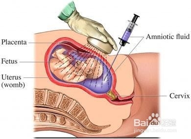 95%的准妈妈常见一些怀孕错误观念