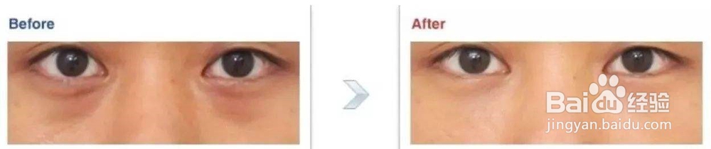 怎么化妆泪沟和黑眼圈