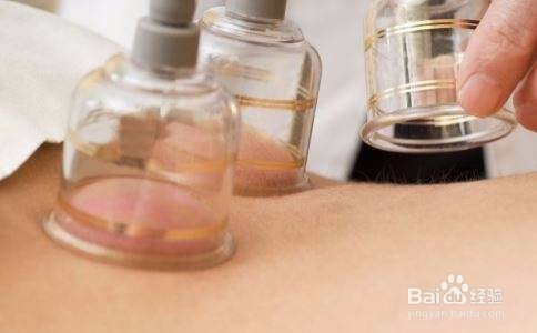 拔罐有什么讲究吗？