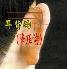 介绍两个防治高血压的中医外治法