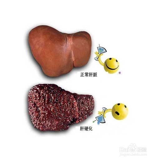 喝酒对肝脏的伤害