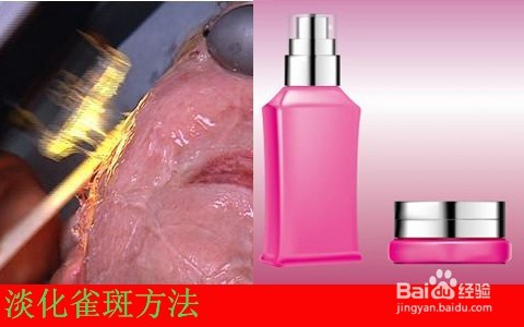 学生祛斑最快最好方法/初中生雀斑能去掉吗