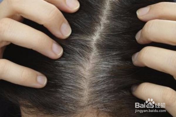 如何从白发的位置判断健康状况？