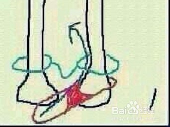 小昭怎么换裤子