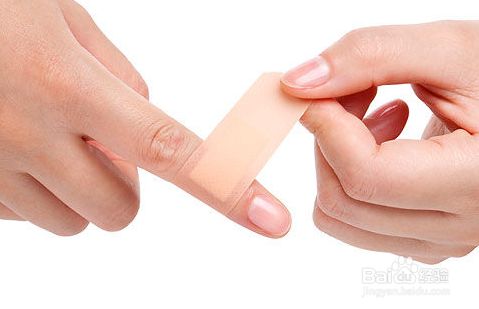 手割破了怎么办能止血 百度经验 手割破了怎么办能止血 百度经验
