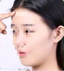 一洗黑怎么用