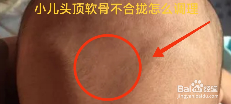 婴儿头顶软骨不合拢怎么调理