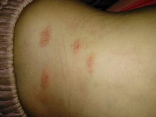 夏天带孩子要注意什么？