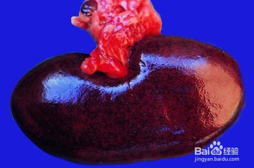 猪丹毒诊断要点及防治