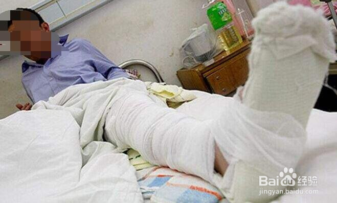 骨折病人吃什么好