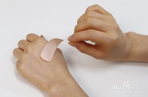 猫咪挠了出血了怎么办