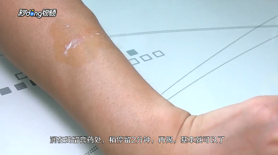 皮肤上的残留膏药怎么能迅速擦掉