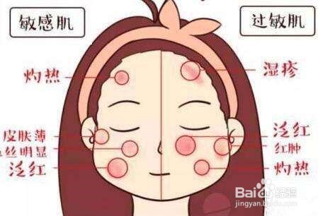 敏感肌应该怎么办