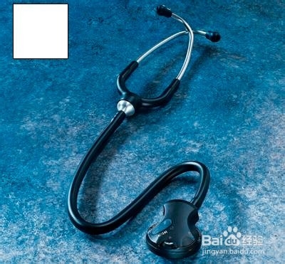 高血压患者哪些项目是必须检查