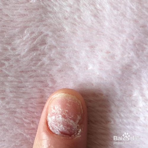黏糊糊的胶怎么去除
