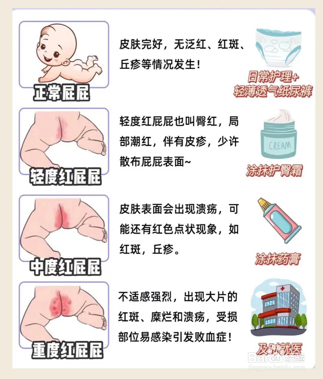 如何预防和护理宝宝红屁屁