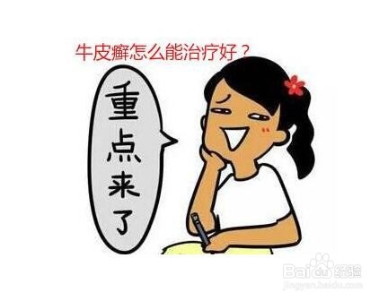 牛皮癣（银屑病）的预防方法与常见病因：