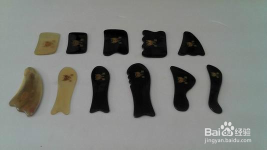 “三度一向”巧用刮痧板