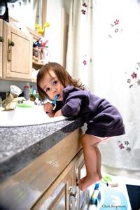 小儿烫伤后的紧急处理及预防