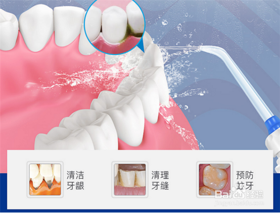 冲牙器(水牙线)使用的技术有哪些