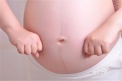 妊娠纹几个月开始出现?孕妇怎么预防妊娠纹