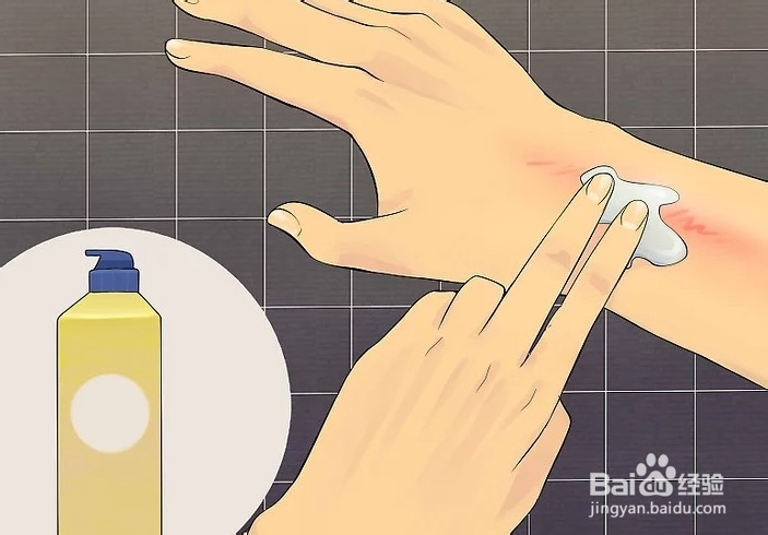 如何治疗皮肤过敏现象