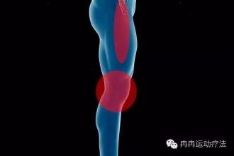 髂胫束磨擦综合症怎么办
