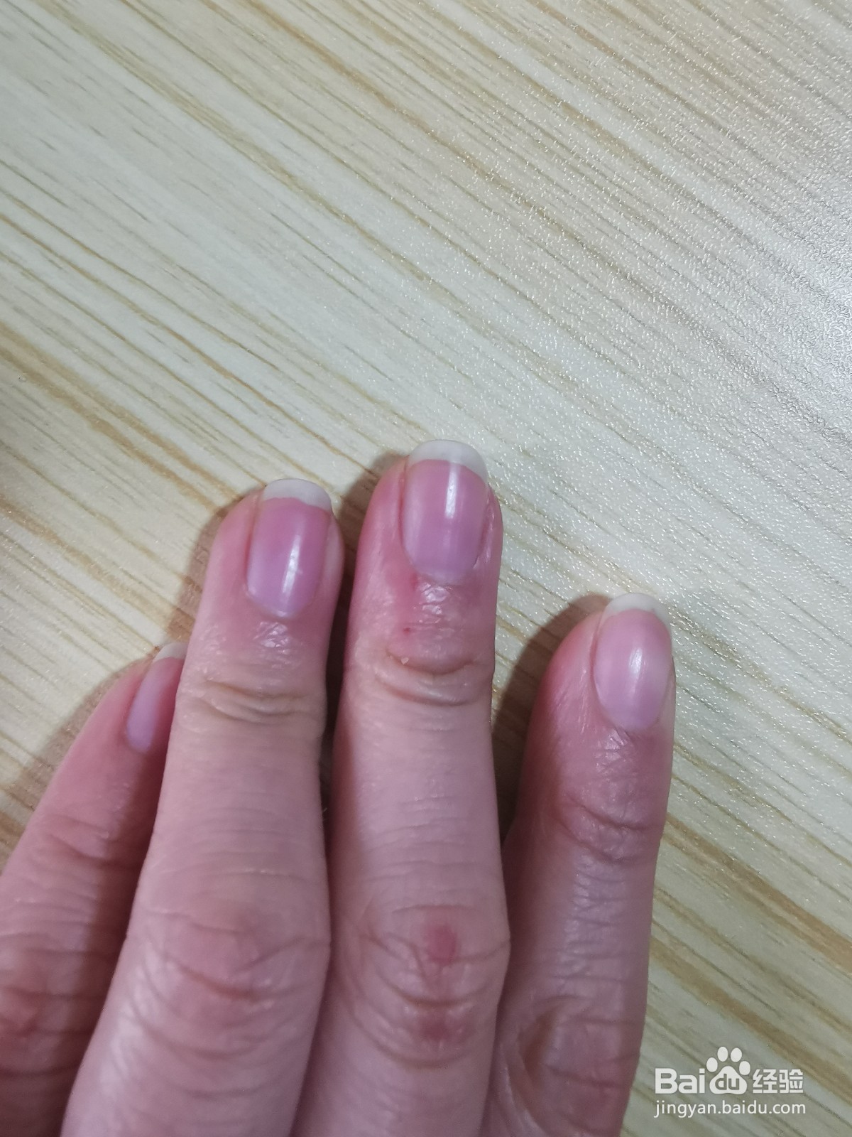 液体创可贴怎么用