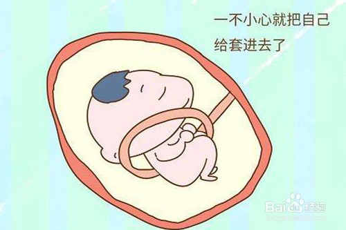 哪几次产检是必须要做的