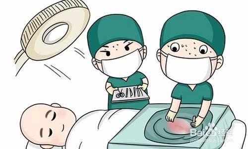 慢性咽炎症状表现哪些,用什么方法治疗