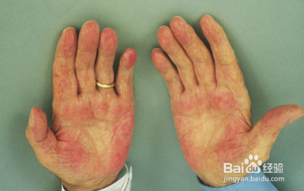 若有这4个“信号”，说明肝脏不太好