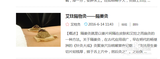 艾灸灸法-隔姜灸