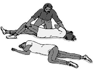 什么情况下需要到医院去看急诊