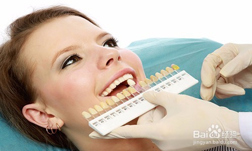 牙齿贴面的种类