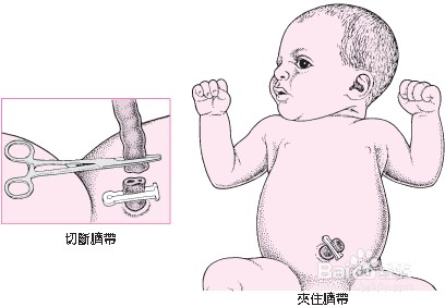 专业月嫂4招解密怎样给新生婴儿护理好脐带