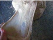 豆沙馅包子的做法