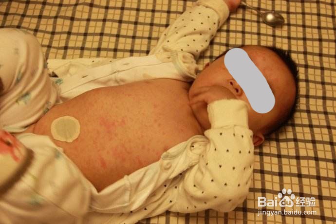 6~18月宝宝突然发烧怎么办？（急疹辨别与处理）