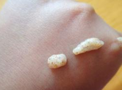 炎炎夏日去除鸡皮疙瘩的方法