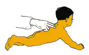 扁桃体炎保健的五原则